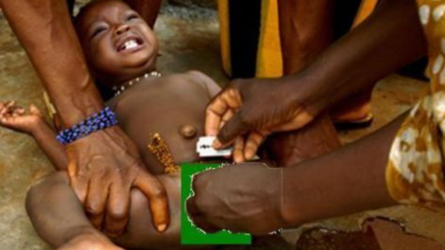 毒害全球2亿女性的割礼，切除女性器官，引发不孕难产的悲剧