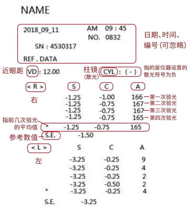 验光单看不懂？ 鹰视菲诺带你1分钟教你读懂验光单