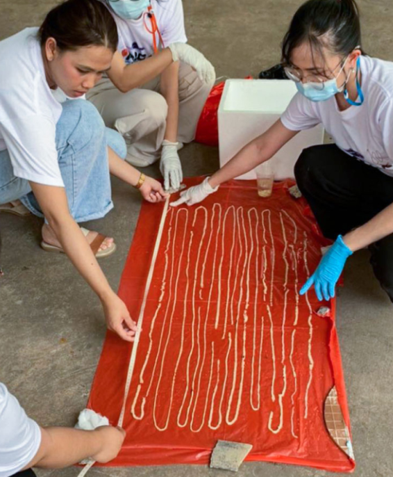 慎入！平时爱吃生牛肉，男子体内养着18米长寄生虫，猛一看像是项链