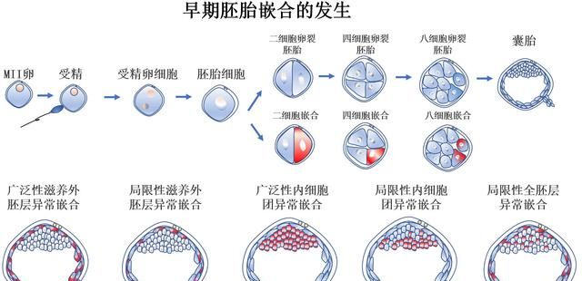 健康夫妻两次怀孕均是罕见病患儿？生殖腺嵌合了解一下