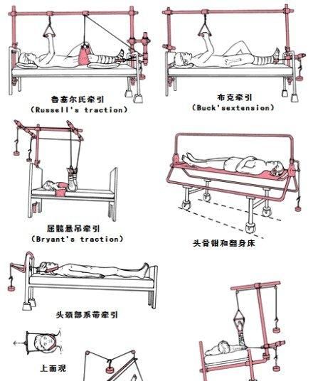 解剖笔记之运动系统,运动解剖学第五版运动系统图13