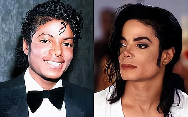 迈克尔·杰克逊做过哪些整容手术，他为何这么做，真的有漂白吗？