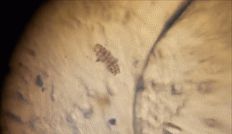 科学家拍到水熊虫暴走的视频！个子仅昆虫1/50万，步态却一模一样