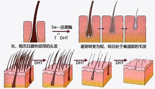 什么是地中海发型(女生剃地中海发型)图10